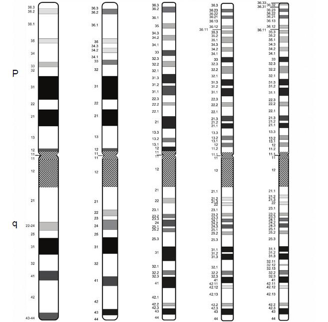 300、400、550、700 和850 条带水平的单倍体核型 图源ISCN_一文读懂染色体核型分析_阅微基因